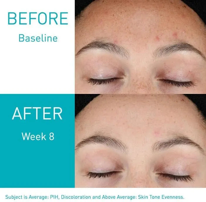 CeraVe Resurfacing Retinol Serum 30ml - Your Key to Glowing Skin