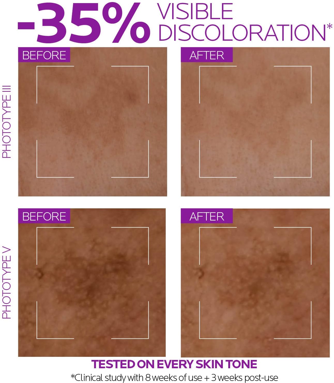 La Roche Posay Pure Niacinamida 10 Serum Concentré Anti-Taches 30 ml