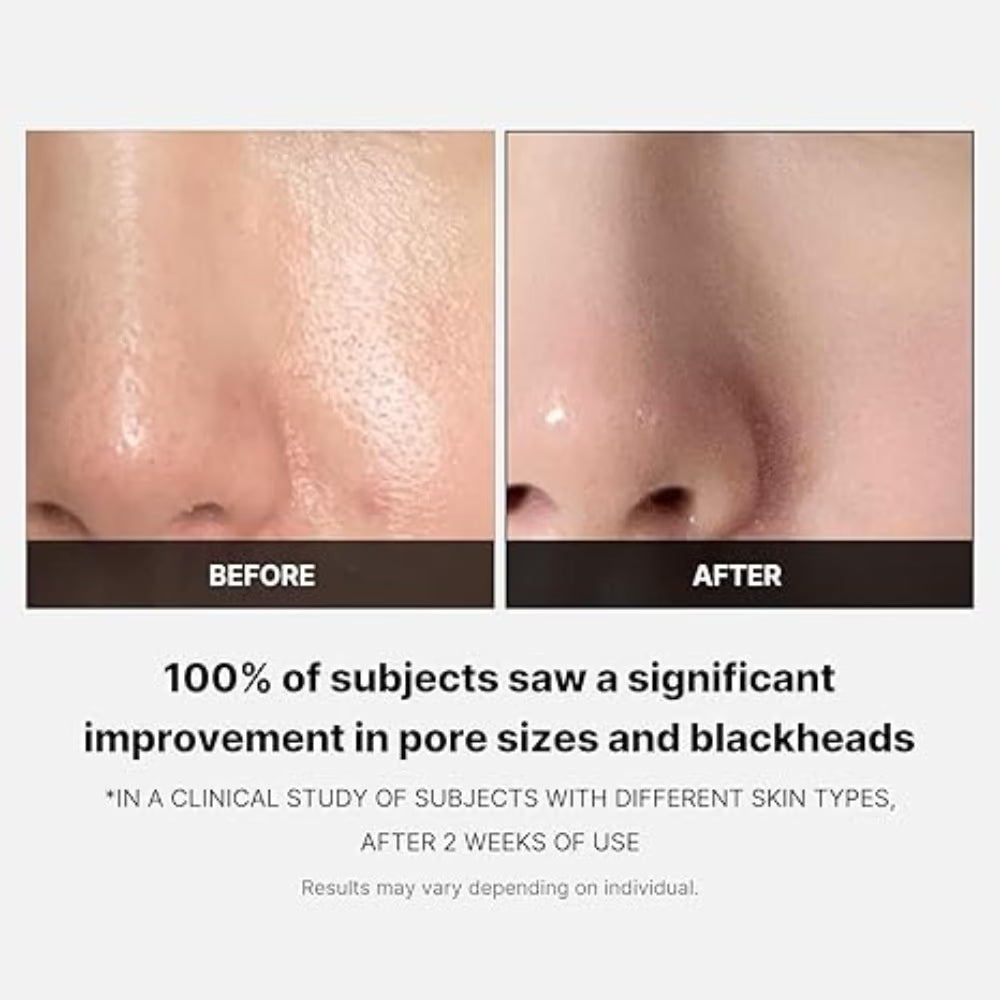 Medicube Zero Pore Pad 70s – Pore Tightening Exfoliating Toner Pads for Smooth Clear Skin | 70 Pads