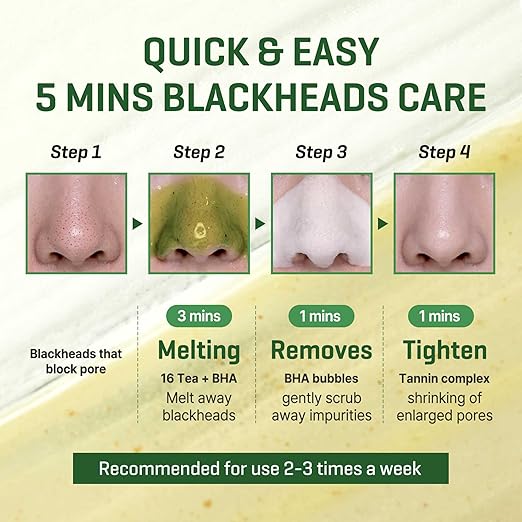 Some By Mi Bye Bye Blackhead | 120G | Korean Face Wash For Removing Blackhead