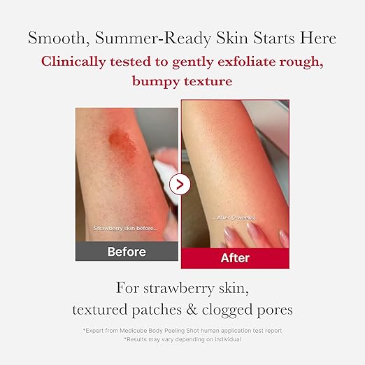 Medicube Red Body Peeling Shot 3.88oz – AHA BHA Succinic Acid Body Spray for Strawberry Skin, Exfoliating & Smoothing Care